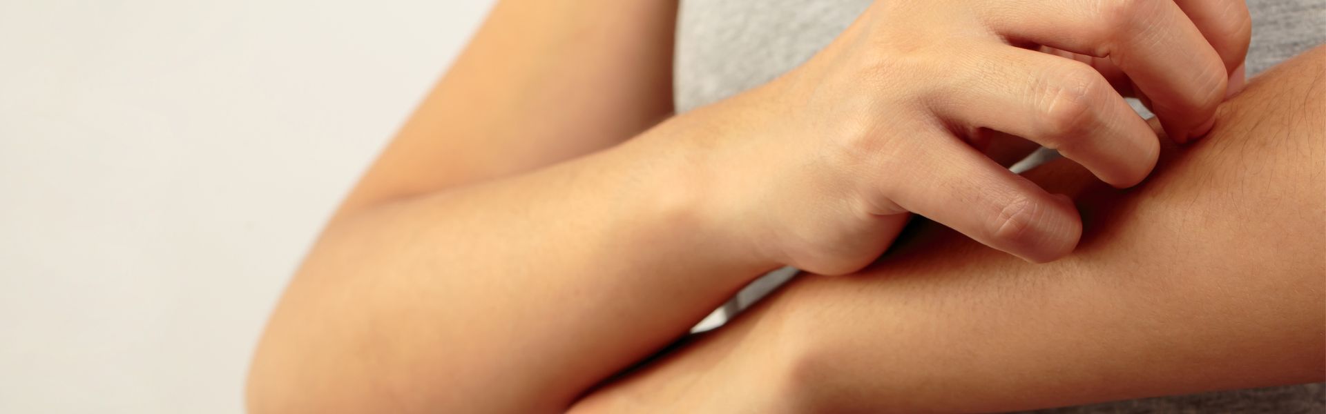 orticaria-portale-me-donna