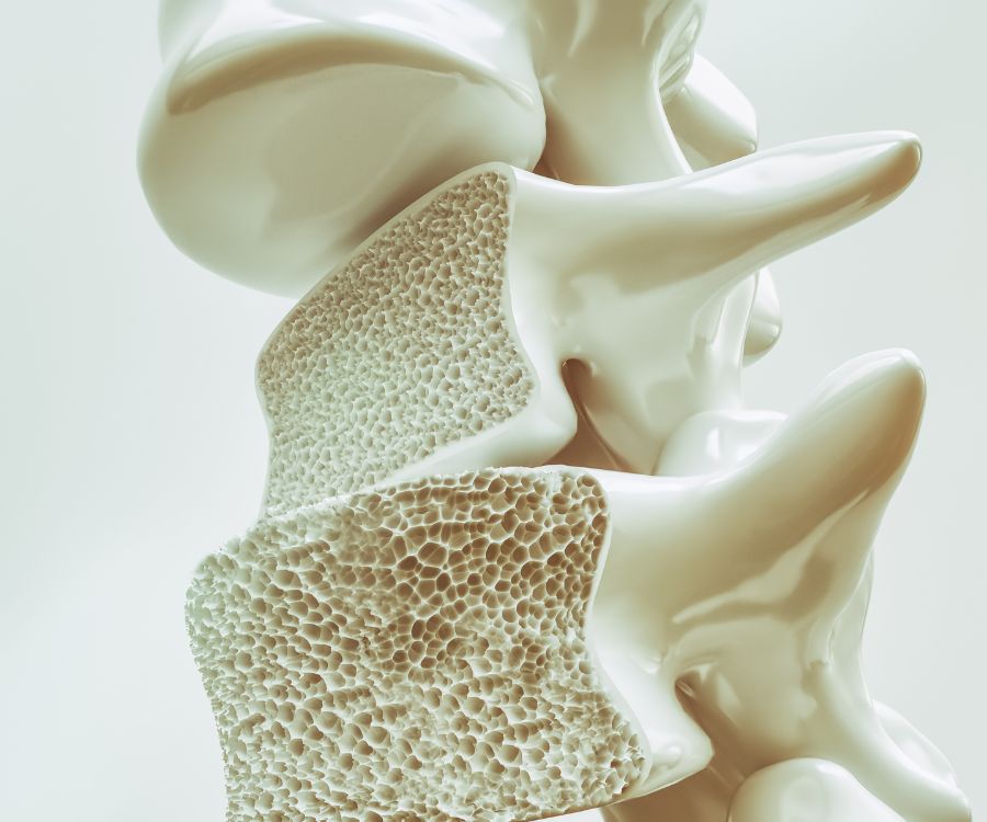 osteoporosi me donna salute
