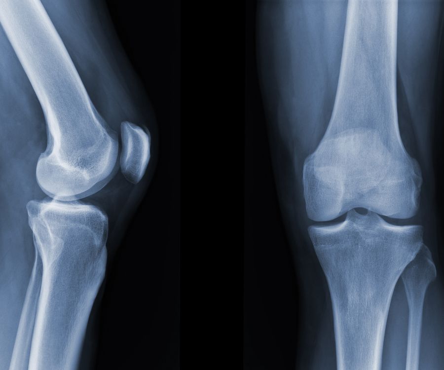 Reumatologia me donna salute