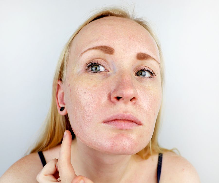 beauty routine pelle grassa